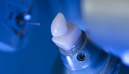 dental veneer milling