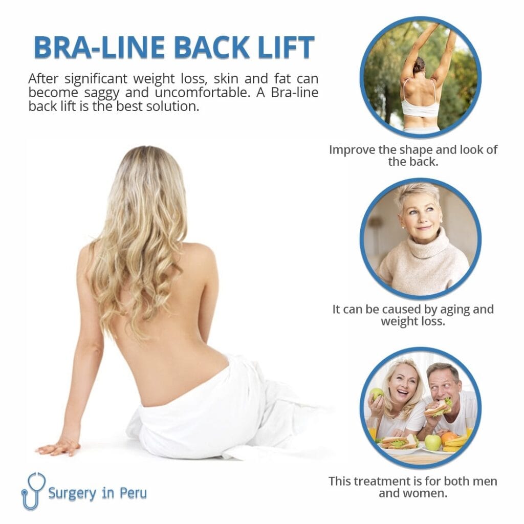 Back Lift BraLine Treatment Plastic Surgery in Peru
