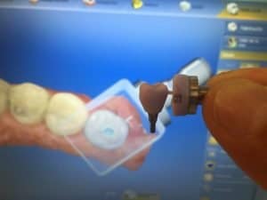 dental treatment in peru