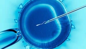 Intracytoplasmic Sperm Microinjection