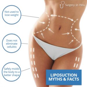 liposuction myths and facts