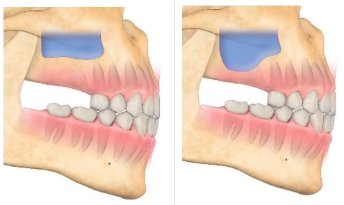 cirugía oral