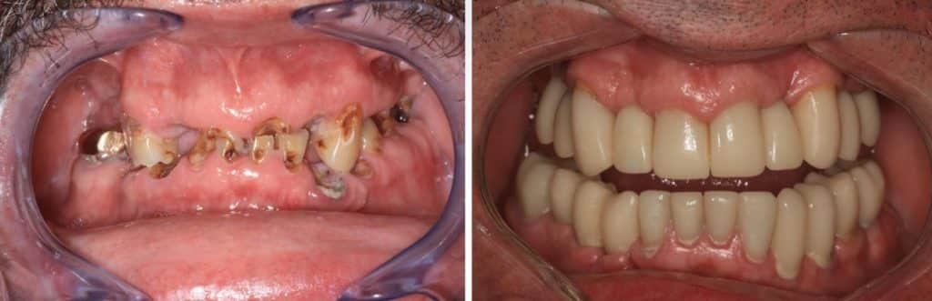cirugía oral lima