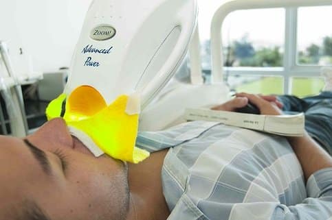 Zoom Teeth Whitening lima peru