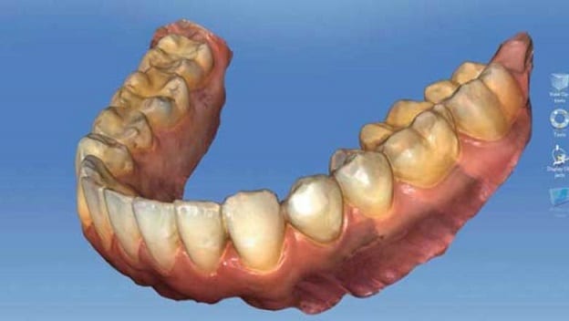 modern dentistry in lima