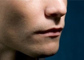 chin implant