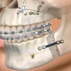 cirugía maxilofacial lima peru