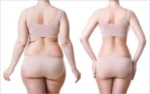 lipo 360