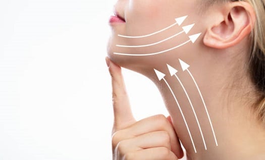 neck lift