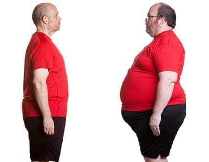 Gastric Bypass